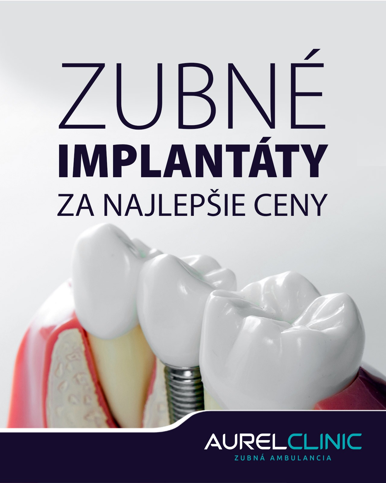 Zubné implantáty